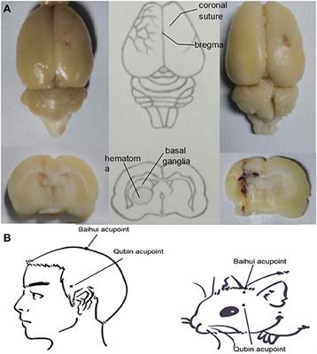 Scalp Acupuncture Attenuates Brain Damage After Intracerebral Hemorrhage Through Enhanced Mitophagy and Reduced Apoptosis in Rats